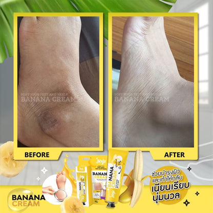 [SG INSTOCK] Joji Secret Young Soft Your Feet and Heels Banana Cream 50g