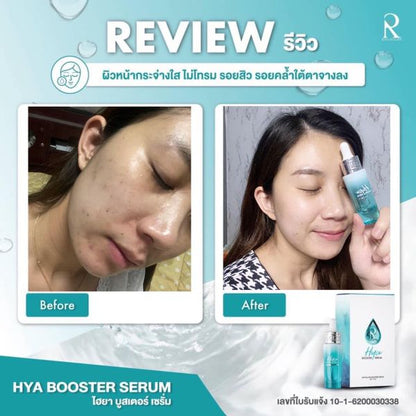 [SG INSTOCK] Ratcha Hya Booster Serum 15ml