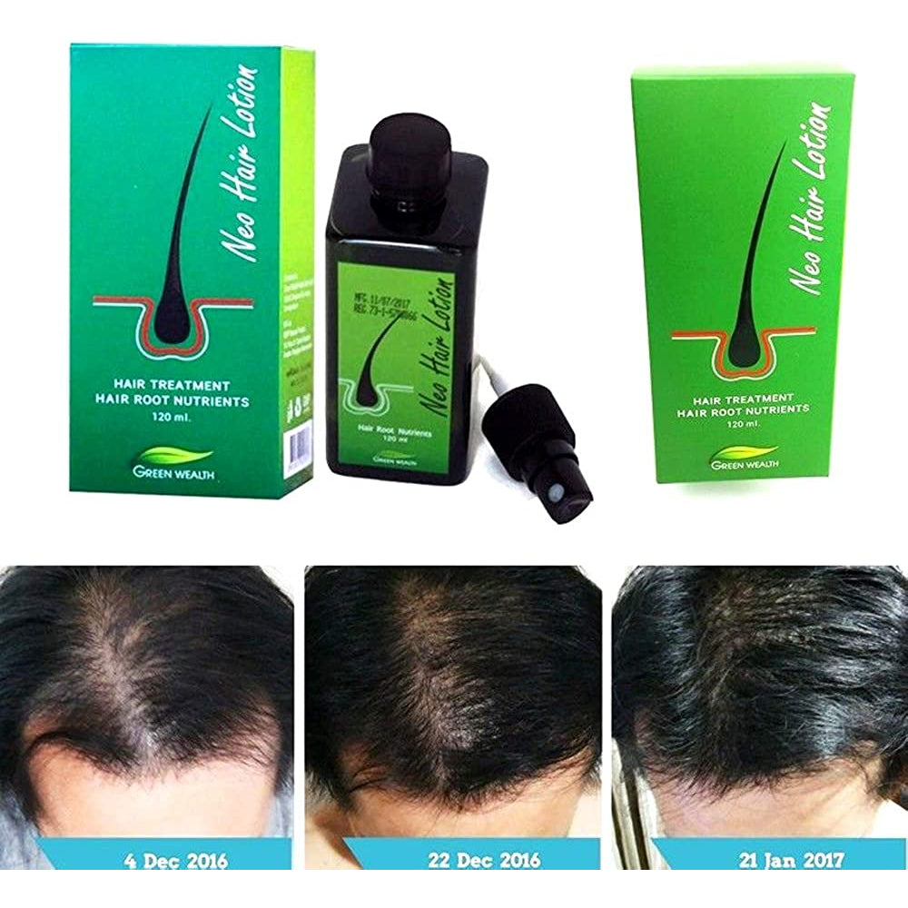 [SG INSTOCK] NEO HAIR LOTION 120ML