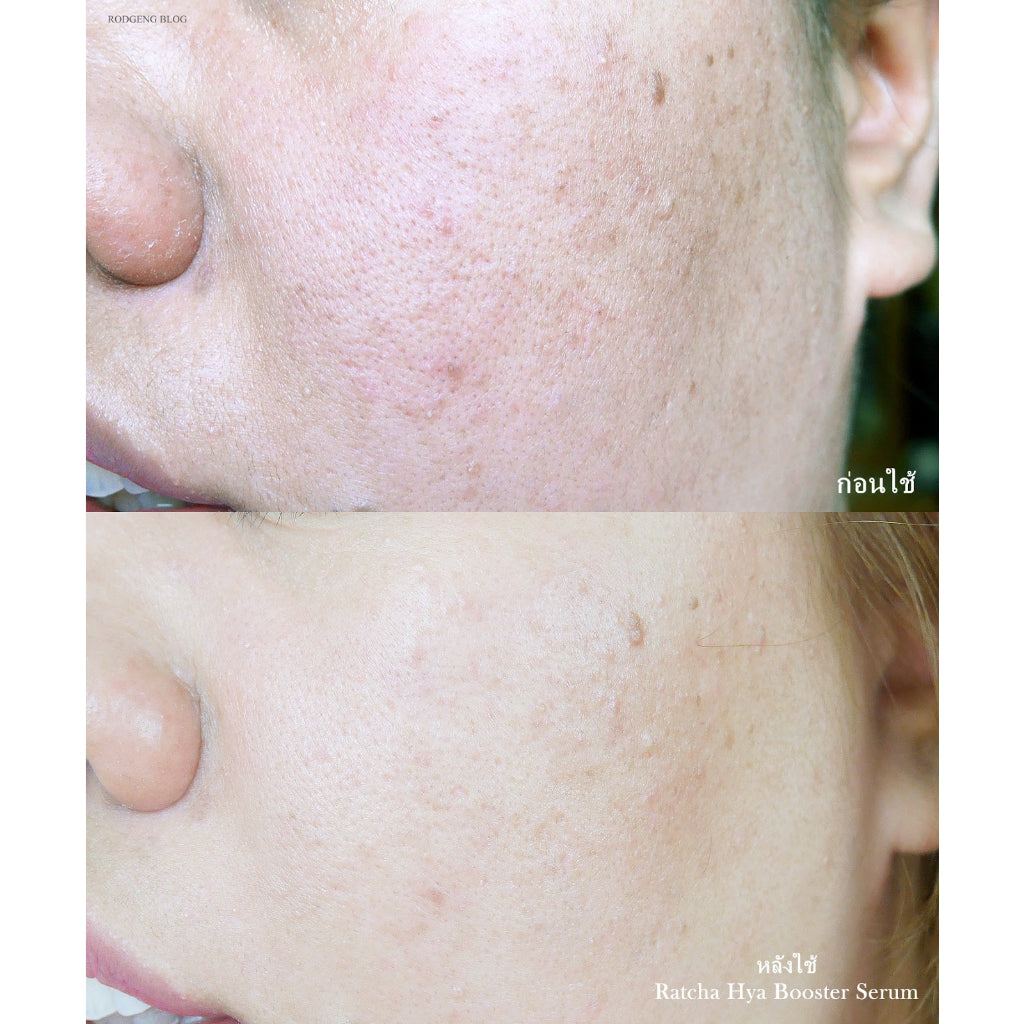 [SG INSTOCK] Ratcha Hya Booster Serum 15ml