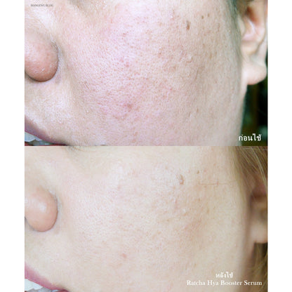 [SG INSTOCK] Ratcha Hya Booster Serum 15ml