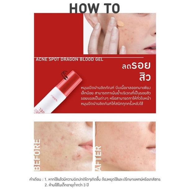 [SG INSTOCK] BABY BRIGHT CLEAR ACNE GEL ,ACNE SPOT DRAGON BLOOD GEL 15G